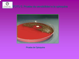 FOTO 5. Prueba de sensibilidad a la optoquina 
Prueba de Optoquina 
 