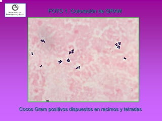 FOTO 1. Coloración de GRAM 
Cocos Gram positivos dispuestos en racimos y tetradas 
 