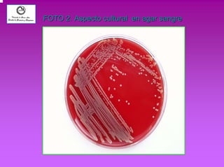 FOTO 2. Aspecto cultural en agar sangre 
 
