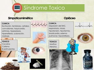 Síndrome Toxico
CLINICA
Excitación, temblores, cefalea,
convulsiones, taquicardia,
arritmias, hiperpirexia,
hiperreflexia, sudoración,
midriasis
TOXICO
Cocaina
Cafeina
B-estimulantes
CLINICA
Depresión del SNC,
respiratoria, miosis,
hipotensión, hipotermia,
bradicardia, edema
pulmonar, hiporreflexia.
TOXICO
Morfina
Heroína
 