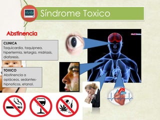Síndrome Toxico
CLINICA
Taquicardia, taquipnea,
hipertermia, letargia, midriasis,
diaforesis.
TOXICO
Abstinencia a
opiáceos, sedantes-
hipnoticos, etanol.
 