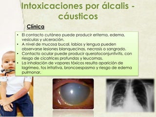 Intoxicaciones por álcalis -
cáusticos
Clínica
• El contacto cutáneo puede producir eritema, edema,
vesículas y ulceración.
• A nivel de mucosa bucal, labios y lengua pueden
observarse lesiones blanquecinas, necrosis o sangrado.
• Contacto ocular puede producir queratoconjuntivitis, con
riesgo de cicatrices profundas y leucomas.
• La inhalación de vapores tóxicos resulta aparición de
lagrimeo, tos irritativa, broncoespasmo y riesgo de edema
pulmonar.
 