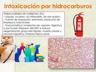 Intoxicación por hidrocarburos
TETRACLORURO DE CARBONO (TC)
– Líquido, incoloro, no inflamable, de olor dulzón.
– Fuente de exposición: extintores, productos de
limpieza e insecticidas.
– Toxicocinética: inhalación de vapores, digestiva
o por la piel. Depresor del SNC e induce
degeneración grasa del hígado, muerte celular y
necrosis hepática. Potente tóxico renal.
 