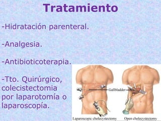 Tratamiento
-Hidratación parenteral.

-Analgesia.

-Antibioticoterapia.

-Tto. Quirúrgico,
colecistectomia
por laparotomía o
laparoscopía.
 