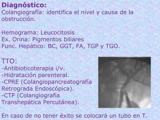 Diagnóstico:
Colangiografía: identifica el nivel y causa de la
obstrucción.

Hemograma: Leucocitosis
Ex. Orina: Pigmentos biliares
Func. Hepático: BC, GGT, FA, TGP y TGO.

TTO:
-Antibioticoterapia i/v.
-Hidratación parenteral.
-CPRE (Colangiopancreatografía
Retrograda Endoscópica).
-CTP (Colangiografía
Transhepática Percutánea).

En caso de no tener éxito se colocará un tubo en T.
 