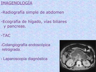 IMAGENOLOGÍA

-Radiografía simple de abdomen

-Ecografía de hígado, vías biliares
 y pancreas.

-TAC

-Colangiografía endoscópica
 retrógrada.

- Laparoscopía diagnóstica
 