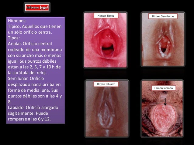 Como hacer la crema por las manos para el aumento del miembro