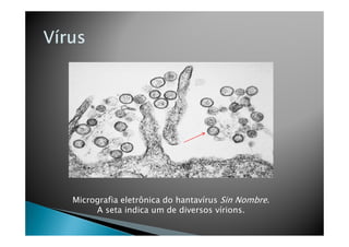 Micrografia eletrônica do hantavírus Sin Nombre.
A seta indica um de diversos vírions.
 