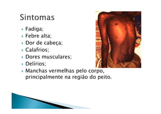 Fadiga;
Febre alta;
Dor de cabeça;
Calafrios;
Dores musculares;Dores musculares;
Delírios;
Manchas vermelhas pelo corpo,
principalmente na região do peito.
 