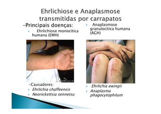 -Principais doenças:
Ehrlichiose monocítica
humana (EMH)
Anaplasmose
granulocítica humana
(AGH)
-Causadores:
Ehrlichia chaffeensis
Neorickettsia sennetsu
Ehrlichia ewingii
Anaplasma
phagocytophilum
 