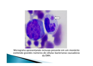 Micrografia apresentando inclusão presente em um monócito
contendo grandes números de células bacterianas causadoras
da EMH.
 