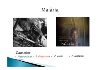 -Causador:
Plasmodium
vivax
P. falciparum P. ovale P. malariae
 