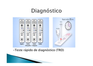 -Teste rápido de diagnóstico (TRD)
 