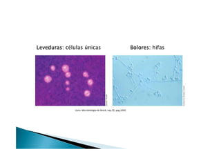 Leveduras: células únicas Bolores: hifas
Livro: Microbiologia de Brock, cap.35, pag.1020.
 