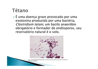 É uma doença grave provocado por uma
exotoxina produzida por uma bactéria,
Clostridium tetani, um bacilo anaeróbio
obrigatório e formador de endósporos, seu
reservatório natural é o solo.
http://microbiology2009.wikispaces.com/file/view/clostridium_tetani.gif/72530635/cl
ostridium_tetani.gif
 