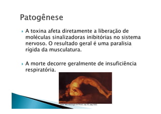 A toxina afeta diretamente a liberação de
moléculas sinalizadoras inibitórias no sistema
nervoso. O resultado geral é uma paralisia
rígida da musculatura.
A morte decorre geralmente de insuficiência
respiratória.
Livro: Microbiologia de Brock, cap.35, pag.1022.
 