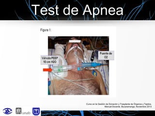 Test de Apnea

Curso en la Gestión de Donación y Trasplante de Órganos y Tejidos.
Manual Docente. Bucaramanga, Noviembre 2013

 