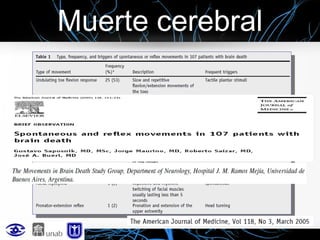 Muerte cerebral

 