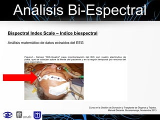 Análisis Bi-Espectral
Bispectral Index Scale – Indice biespectral
Análisis matemático de datos extraidos del EEG

Curso en la Gestión de Donación y Trasplante de Órganos y Tejidos.
Manual Docente. Bucaramanga, Noviembre 2013

 