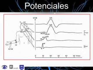 Potenciales
evocados

 