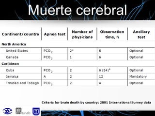 Muerte cerebral

 
