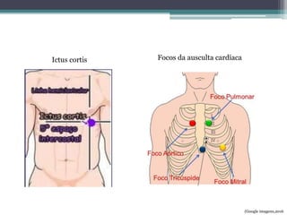 Ictus cortis Focos da ausculta cardíaca
(Google imagens,2016
 