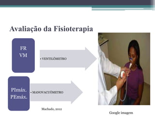 Avaliação da Fisioterapia
• VENTILÔMETRO
FR
VM
• MANOVACUÔMETRO
PImáx.
PEmáx.
Google imagem
Machado, 2012
 