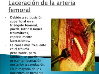 Debido a su posición superficial en el triángulo femoral, puede sufrir lesiones traumáticas, especialmente laceraciones. La causa más frecuente es el trauma penetrante, pero también se puede presentar laceración posterior a canulación.  En la mayoría de los pacientes se presenta sangrado masivo que ocasiona severa hipovolemia 