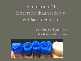 Seminario n°4
Encerado diagnostico y
enfilado dentario
Catalina Galleguillos M.
Dra Katina Marinkovic
 