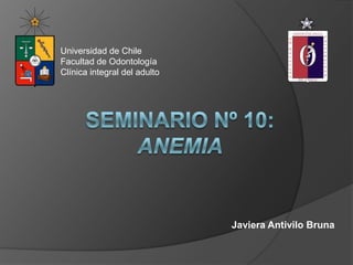 Universidad de Chile
Facultad de Odontología
Clínica integral del adulto




                              Javiera Antivilo Bruna
 