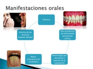 Halitosis
Alta prevalencia
de enfermedad
periodontal
crónica
Hemorragias por
alteración d
factores de la
coagulación
Mayor
prevalencia de
candidiasis
Ictericia de las
mucosas
(paladar blando)
 