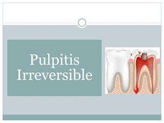 Pulpitis
Irreversible
 