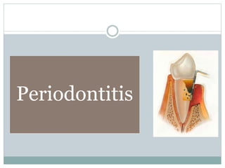 Periodontitis
 