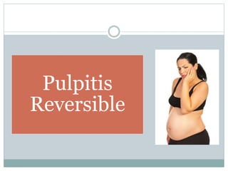 Pulpitis
Reversible
 