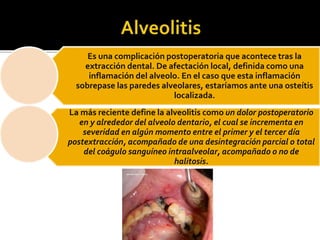 Es una complicación postoperatoria que acontece tras la
extracción dental. De afectación local, definida como una
inflamac...