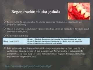 Regeneración tisular guiada
 Recuperación de hueso perdido (mediante tejido óseo propiamente tal, conectivo o
elementos sintéticos)
 Mejora la anatomía local, función y pronóstico de un diente en particular o de una zona del
maxilar o la mandíbula
 Compromisos de furca:
 Principales mejorías clínicas: defectos infra óseos, compromisos de furca clase I y II y
deshicencias óseas (al menos 1,5 mm a cresta ósea). NO es posible el tratamiento de
compromisos de furca clase III (optar por hemisección, colgajos de acceso, membranas
regenerativas, cirugía túnel, etc.)
http://scielo.isciii.es/pdf/peri/v22n3/original3.pdf
 