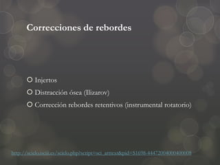 Correcciones de rebordes
 Injertos
 Distracción ósea (Ilizarov)
 Corrección rebordes retentivos (instrumental rotatorio)
http://scielo.isciii.es/scielo.php?script=sci_arttext&pid=S1698-44472004000400008
 