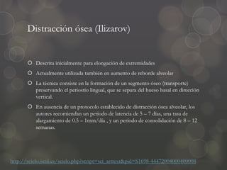Distracción ósea (Ilizarov)
 Descrita inicialmente para elongación de extremidades
 Actualmente utilizada también en aumento de reborde alveolar
 La técnica consiste en la formación de un segmento óseo (transporte)
preservando el periostio lingual, que se separa del hueso basal en dirección
vertical.
 En ausencia de un protocolo establecido de distracción ósea alveolar, los
autores recomiendan un periodo de latencia de 5 – 7 días, una tasa de
alargamiento de 0.5 – 1mm/día , y un período de consolidación de 8 – 12
semanas.
http://scielo.isciii.es/scielo.php?script=sci_arttext&pid=S1698-44472004000400008
 