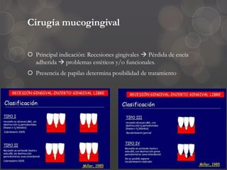 Cirugía mucogingival
 Principal indicación: Recesiones gingivales  Pérdida de encía
adherida  problemas estéticos y/o funcionales.
 Presencia de papilas determina posibilidad de tratamiento
 