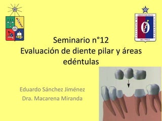 Seminario n°12
Evaluación de diente pilar y áreas
edéntulas
Eduardo Sánchez Jiménez
Dra. Macarena Miranda
 