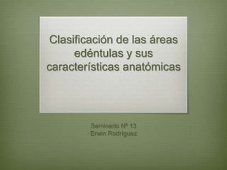 Clasificación de las áreas
      edéntulas y sus
características anatómicas




        Seminario Nº 13
        Erwin Rodríguez
 