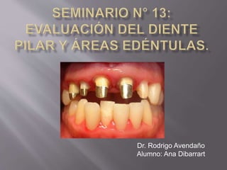 Dr. Rodrigo Avendaño
Alumno: Ana Dibarrart
 
