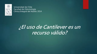 ¿El uso de Cantilever es un
recurso válido?
Universidad de Chile
Facultad de Odontología
Clínica Integral del Adulto 2014
 