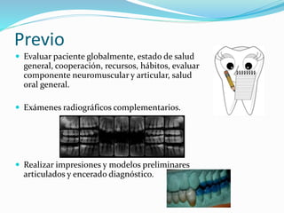 Previo
 Evaluar paciente globalmente, estado de salud
general, cooperación, recursos, hábitos, evaluar
componente neuromuscular y articular, salud
oral general.
 Exámenes radiográficos complementarios.
 Realizar impresiones y modelos preliminares
articulados y encerado diagnóstico.
 