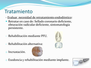 Tratamiento
- Evaluar necesidad de retratamiento endodóntico:
 Retratar en caso de: Sellado coronario deficiente,
obturación radicular deficiente, sintomatología
persistente.
- Rehabilitación mediante PFU.
- Rehabilitación alternativa:
o Incrustación.
o Exodoncia y rehabilitación mediante implante.
 