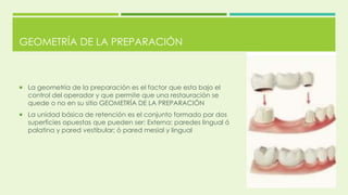 GEOMETRÍA DE LA PREPARACIÓN
 La geometría de la preparación es el factor que esta bajo el
control del operador y que permite que una restauración se
quede o no en su sitio GEOMETRÍA DE LA PREPARACIÓN
 La unidad básica de retención es el conjunto formado por dos
superficies opuestas que pueden ser: Externa: paredes lingual ó
palatina y pared vestibular; ó pared mesial y lingual
 