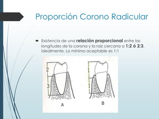 Proporción Corono Radicular
 Existencia de una relación proporcional entre las
longitudes de la corona y la raíz cercana a 1:2 ó 2:3,
idealmente. Lo mínimo aceptable es 1:1
 