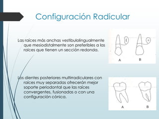 Configuración Radicular
Las raíces más anchas vestibulolingualmente
que mesiodistalmente son preferibles a las
raíces que tienen un sección redonda.
Los dientes posteriores multirradiculares con
raíces muy separadas ofrecerán mejor
soporte periodontal que las raíces
convergentes, fusionadas o con una
configuración cónica.
 