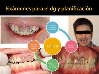 Clínicos
Examen
dentario
individual
Análisis
estético
Examen en
oclusión
dinámica
Examen en
oclusión
estática
 