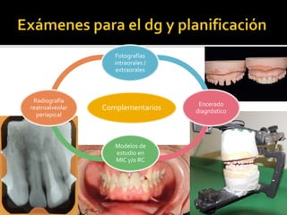 Complementarios
Fotografías
intraorales /
extraorales
Encerado
diagnóstico
Modelos de
estudio en
MIC y/o RC
Radiografía
re...